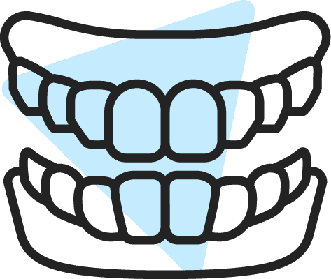 Anpassade bettskenor