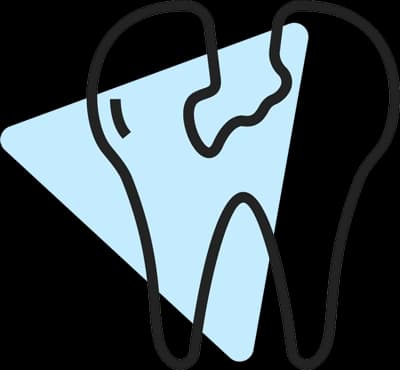 Tooth extraction