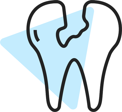 Illustration av en trasig tand